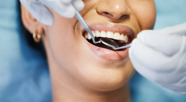 Best Emergency Wisdom Teeth Removal in Alturas, FL